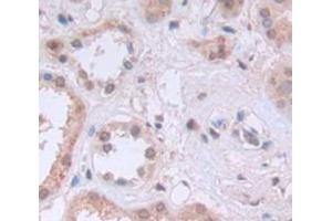 Used in DAB staining on fromalin fixed paraffin- embedded Kidney tissue (KPNB1 anticorps  (AA 21-441))
