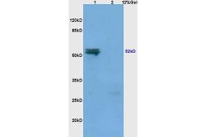 Lane 1: mouse spleen lysates Lane 2: mouse liver lysates probed with Anti MMP-3 Polyclonal Antibody, Unconjugated (ABIN668301) at 1:200 in 4 °C. (MMP3 anticorps  (AA 401-477))
