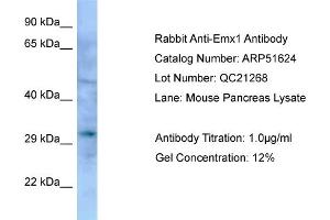 WB Suggested Anti-Emx1 Antibody   Titration: 1. (EMX1 anticorps  (Middle Region))