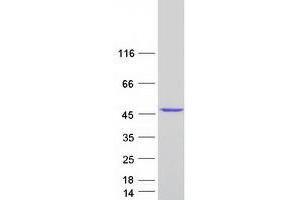 Validation with Western Blot