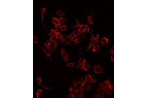 ABIN6268823 staining HuvEc by IF/ICC. (CD69 anticorps  (Internal Region))
