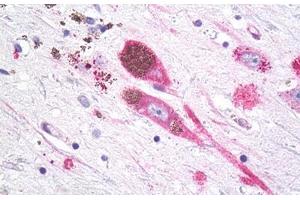 Anti-MC1R antibody IHC staining of brain, substantia nigra, neurons. (MC1 Receptor anticorps  (Cytoplasmic Domain))