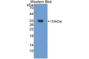 Western blot analysis of the recombinant protein. (FOXM1 anticorps  (AA 209-460))