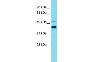 Host: Rabbit Target Name: CCDC137 Sample Type: Jurkat Whole Cell lysates Antibody Dilution: 1. (CCDC137 anticorps  (N-Term))
