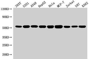 Western Blot Positive WB detected in: 293T whole cell lysate, U251 whole cell lysate, A549 whole cell lysate, HepG2 whole cell lysate, Hela whole cell lysate, MCF-7 whole cell lysate, Jurkat whole cell lysate, U87 whole cell lysate, K562 whole cell lysate All lanes: SLC25A24 antibody at 1:1500 Secondary Goat polyclonal to rabbit IgG at 1/50000 dilution Predicted band size: 54, 52 kDa Observed band size: 54 kDa (SLC25A24 anticorps  (AA 1-197))