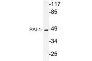Western blot analysis of PAI-1 Antibody in extracts from Jurkat cells. (PAI1 anticorps)
