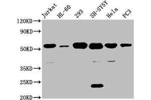 Western Blot Positive WB detected in: Jurkat whole cell lysate, HL60 whole cell lysate, 293 whole cell lysate, SH-SY5Y whole cell lysate, Hela whole cell lysate, PC-3 whole cell lysate All lanes: CYP21A2 antibody at 8 μg/mL Secondary Goat polyclonal to rabbit IgG at 1/50000 dilution Predicted band size: 56, 53 kDa Observed band size: 56 kDa (CYP21A2 anticorps  (AA 312-418))