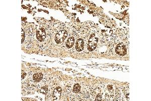 anti-Ornithine Aminotransferase (OAT) (AA 214-439) antibody