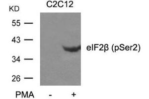 Western blot analysis of extracts from C2C12 cells untreated or treated with PMA using eIF2b(phospho-Ser2) Antibody.