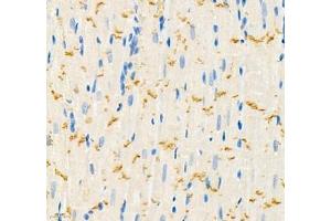 Immunohistochemistry of paraffin embedded rat heart using THNSL2 (ABIN7075893) at dilution of 1: 400 (400x lens)