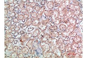 Immunohistochemical analysis of paraffin-embedded human-kidney, antibody was diluted at 1:200 (CD300E anticorps)