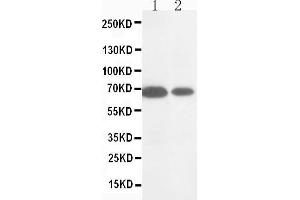 Anti-MMP16 antibody, Western blotting Lane 1: HELA Cell Lysate Lane 2: COLO320 Cell Lysate