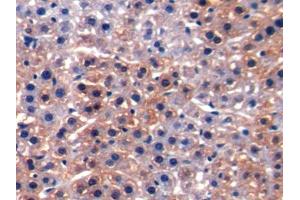 DAB staining on IHC-P; Samples: Rat Liver Tissue