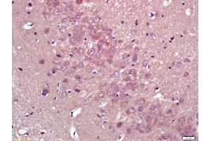 Formalin-fixed and paraffin embedded rat brain labeled with Anti-HMGCR Polyclonal Antibody, Unconjugated (ABIN709196) at 1:200 followed by conjugation to the secondary antibody and DAB staining