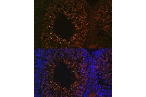 Immunofluorescence analysis of rat testis using LDHB antibody (ABIN7268168) at dilution of 1:100.