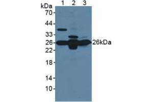 Western blot analysis of (1) Mouse Brain Tissue, (2) Mouse Liver Tissue and (3) Mouse Kidney Tissue. (GSTM1 anticorps  (AA 1-218))