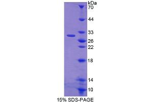 Image no. 1 for ATP-Binding Cassette, Sub-Family F (GCN20), Member 2 (ABCF2) (AA 396-623) protein (T7 tag,His tag) (ABIN6239299) (ABCF2 Protein (AA 396-623) (T7 tag,His tag))