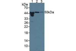 Western blot analysis of (1) Human Serum, (2) Rat Pancreas Tissue and (3) Rat Bladder Tissue. (ORM1 anticorps  (AA 19-201))