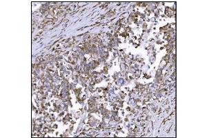 IHC analysis of LRP1B using anti-LRP1B antibody (ABIN7601521). (LRP1B anticorps  (AA 3704-4547))