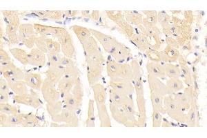 Detection of RARS in Human Cardiac Muscle Tissue using Monoclonal Antibody to Arginyl tRNA Synthetase (RARS) (RARS anticorps  (AA 1-146))