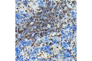 Immunohistochemistry of paraffin-embedded rat spleen using PIK3CG Rabbit pAb (ABIN6130600, ABIN6145638, ABIN6145639 and ABIN6222396) at dilution of 1:100 (40x lens).