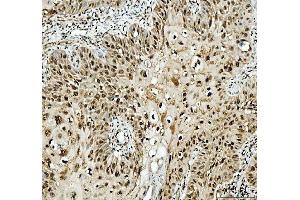 IHC analysis of SFPQ using anti-SFPQ antibody (ABIN7603089). (SFPQ anticorps  (Middle Region))