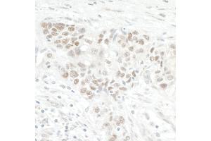 Immunohistochemistry (IHC) image for anti-Nucleolar Protein 12 (NOL12) (AA 163-213) antibody (ABIN7454859)