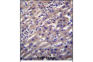 SCP2 Antibody (N-term) (ABIN656448 and ABIN2845733) immunohistochemistry analysis in formalin fixed and paraffin embedded human liver tissue followed by peroxidase conjugation of the secondary antibody and DAB staining. (SCP2 anticorps  (N-Term))