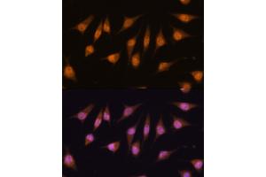 Immunofluorescence analysis of L-929 cells using MyoD1 antibody  at dilution of 1:100. (MYOD1 anticorps  (AA 150-250))