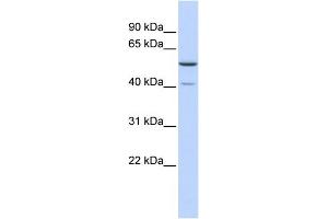 METT5D1 anticorps  (N-Term)