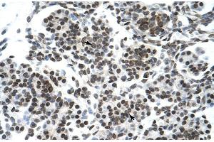 Rabbit Anti-ZNF394 Antibody Catalog Number: ARP30072 Paraffin Embedded Tissue: Human Pancreas Cellular Data: Epithelial cells of pancreatic acinus Antibody Concentration: 4. (ZNF394 anticorps  (N-Term))