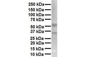 WB Suggested Anti-TRPV4 antibody Titration: 1 ug/mL Sample Type: Human heart