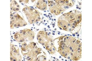 Immunohistochemistry of paraffin-embedded Human normal stomach using CHIT1 Polyclonal Antibody at dilution of 1:200 (40x lens). (Chitotriosidase 1 anticorps)