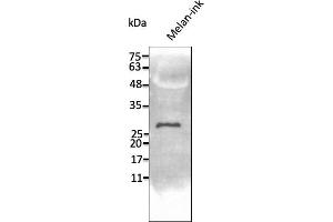 Western Blotting (WB) image for anti-Transmembrane Protein 160 (TMEM160) (C-Term) antibody (ABIN7273067) (TMEM160 anticorps  (C-Term))