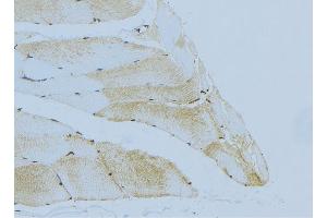 ABIN6276446 at 1/100 staining Mouse muscle tissue by IHC-P. (Hexokinase 2 anticorps  (C-Term))