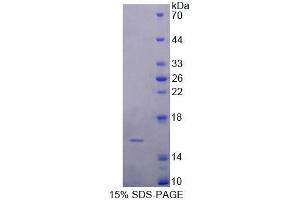 SDS-PAGE analysis of Human FABP4 Protein. (FABP4 Protéine)