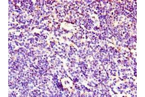 Immunohistochemistry of paraffin-embedded human lymph node tissue using ABIN7158656 at dilution of 1:100 (LEF1 anticorps  (AA 75-216))