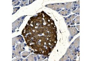 IHC analysis of SYP using anti-SYP antibody (ABIN7603120). (Synaptophysin anticorps  (N-Term))
