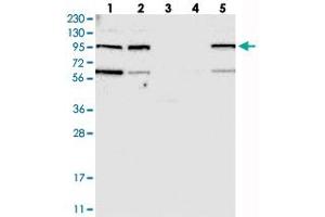Western blot analysis of Lane 1: RT-4, Lane 2: U-251 MG, Lane 3: Human Plasma, Lane 4: Liver, Lane 5: Tonsil with KIAA0753 polyclonal antibody  at 1:250-1:500 dilution. (KIAA0753 anticorps)