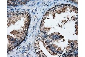 Immunohistochemical staining of paraffin-embedded Kidney tissue using anti-XRCC1mouse monoclonal antibody. (XRCC1 anticorps)