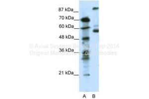 Host: Rabbit Target Name: HTR7 Sample Tissue: Human Jurkat Antibody Dilution: 1ug/ml (HTR7 anticorps  (N-Term))