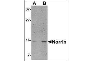 Western blot analysis of Norrin in Jurkat cell lysate with this product at (A) 1 and (B) 2 μg/ml. (Norrie Disease (Pseudoglioma) anticorps  (N-Term))