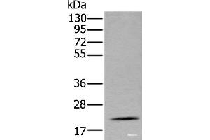 Western blot analysis of Mouse fat tissue lysate using ZFAND5 Polyclonal Antibody at dilution of 1:500 (ZFAND5 anticorps)