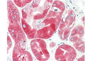 Anti-58K Golgi Protein / FTCD antibody IHC staining of human kidney.