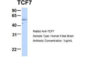 Host:  Rabbit  Target Name:  TCF7  Sample Type:  Human Fetal Brain  Antibody Dilution:  1. (TCF7 anticorps  (Middle Region))