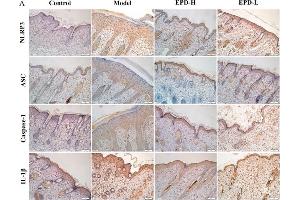 EPD inhibited the IMQ-activated nucleotide-binding oligomerization domain (Nod)-like receptor family pyrin domain-containing 3 (NLRP3) inflammasome signaling pathway.