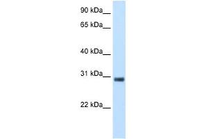 KCTD6 antibody used at 5 ug/ml to detect target protein. (KCTD6 anticorps  (N-Term))
