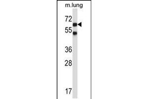 Western blot analysis in mouse lung tissue lysates (35ug/lane). (Nemo-Like Kinase anticorps  (C-Term))