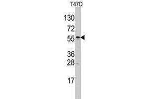 Western blot analysis of ALDH6A1 polyclonal antibody  in T-47D cell line lysates (35 ug/lane). (ALDH6A1 anticorps  (N-Term))