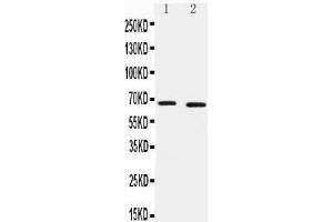 Anti-IRAKM antibody,  Western blotting Lane 1: HELA Cell Lysate Lane 2: JURKAT Cell Lysate